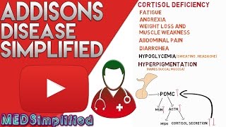 Addisons Disease Made Simple  Primary Adrenal Faliure [upl. by Nylarej]