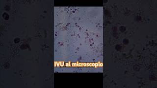 Así se ve una muestra de orina cuando hay INFECCIÓN laboratorioclinico uroanalisis short [upl. by Dodds]