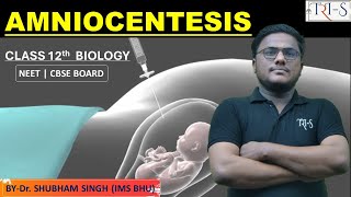 AMNIOCENTESIS  CLASS 12th BIOLOGY  NEET CBSE BOARD BY  Dr SHUBHAM SINGH IMS BHU [upl. by Leiva298]