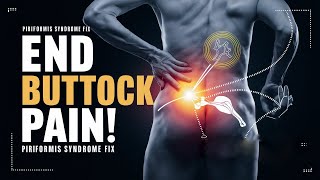 How to Fix Buttock Pain for Good  Piriformis Syndrome [upl. by Wit181]