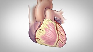 Coronary Artery Bypass Surgery [upl. by Alysoun]