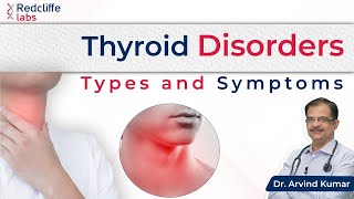 What are Thyroid Disorders जानें Thyroid के लक्षण कारण और इलाज के बारे में  Dr Arvind Kumar [upl. by Akinert]