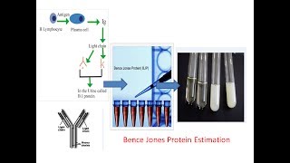 Urinalysis  Urine Dipstick Test  OSCE Guide  UKMLA  CPSA [upl. by Cassius]