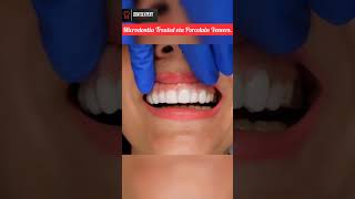 Microdontia Small size Teeth Treated via Porcelain Veneers shorts veneers dentition viral [upl. by Larue]