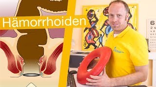 Hämorrhoiden ⚡️ Erkennen Behandeln amp Hilfsmittel [upl. by Silyhp]