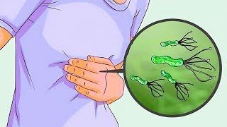 6 Proven Natural Remedies for H Pylori [upl. by Basile]