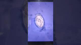 Strongyloides egg in a fecal sample microscopic slide [upl. by Notniuq911]