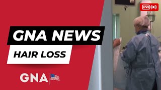 GNA News  how to cure alopecia and hair loss [upl. by Arama262]