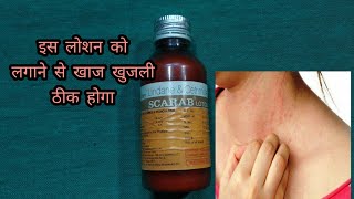 Scarab lotion  lindane and certified lotion  खाज खुलजी के दवा [upl. by Osnofla]