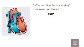 Infective endocarditis symptoms mnemonics [upl. by Finkelstein]