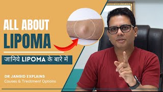 All About Lipoma  What are the causes and treatment options for Lipma  Lipoma Surgery in Delhi [upl. by Berte]