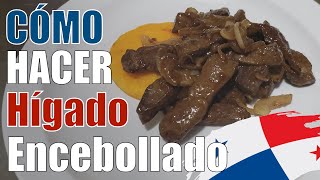 Hígado encebollado Panameño  Zu cocina [upl. by Nevarc]