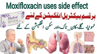 moxifloxacin 400 mg uses in urdu moxifloxacin 400 mg  Mofest 400mg  X gen 400mg  Avelox 400mg [upl. by Betz]