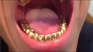 Gold Teeth Grillz [upl. by Ttimme700]