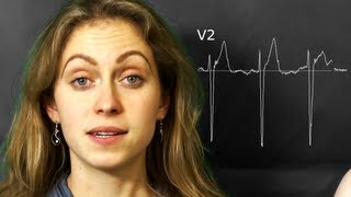 ECG The precordialchest leads V1V6 [upl. by Margot]