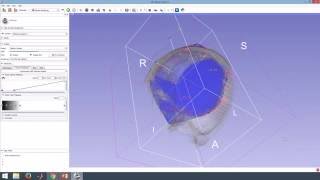 Volume clipping cropping with Model on Slicer 3D [upl. by Manuel]