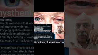 Myasthenia gravis dailyhealthtips muscularweakness [upl. by Ykcaj]