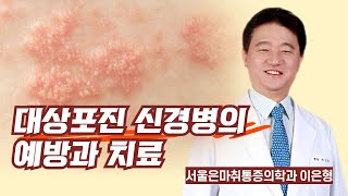 대상포진 신경병의 예방과 치료  서울은마취통증의학과 이은형 [upl. by Brenan]