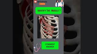 Identify the Muscle of upper limb quiz anatomy humananatomy upperlimuscles [upl. by Eidorb]