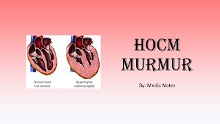 HOCM murmur  pathophysiology in beta blockers squatting Valsalva [upl. by Hartley]