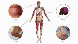 Primal’s Abnormal Anatomy Showcase Crohns Disease [upl. by Wilkins]