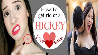 how to give someone a hickey on the neck fast tutorial [upl. by Stearn]