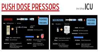 Push Dose Vasopressors For Management Of Shock In The ICU [upl. by Suruat]