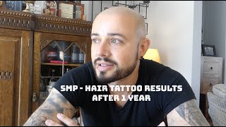 Scalp Micro Pigmentation SMP after 1 year [upl. by Andrea462]