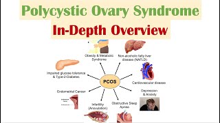 Polycystic Ovary Syndrome PCOS  Overview of Associated Conditions Diagnosis amp Treatments [upl. by Theodosia]