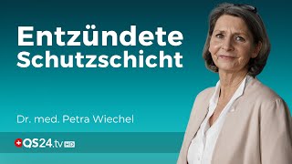 Schleimhautentzündungen  Ein Hinweis auf stille Entzündungen  Dr med Petra Wiechel  QS24 [upl. by Ailehs]