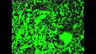 Glowing Mycobacteria [upl. by Enej]