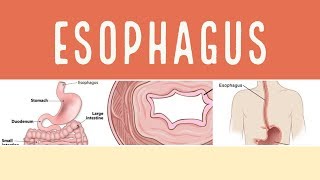 PATHOLOGY OF ESOPHAGUS  GI PATHOLOGY  The White Army [upl. by Alegnaed]