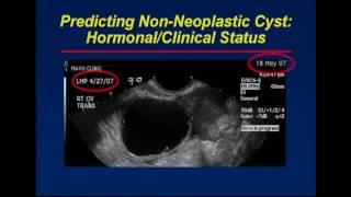 Ovary Patterns Pearls and Pitfalls in Adnexal Imaging [upl. by Zenitram657]