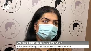 Live Haarpigmentierung  3 Sitzung für Elif  Haarausfall Lösung  Modern Hair Loss Solution [upl. by Ayotnahs]