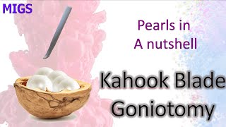 Kahook blade goniotomy │ Pearls in A Nutshell 7 [upl. by Atiuqrahs]