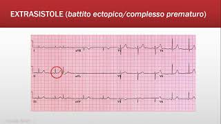 ECG Base Ritmo  Quiz FOAMed [upl. by Tengdin]