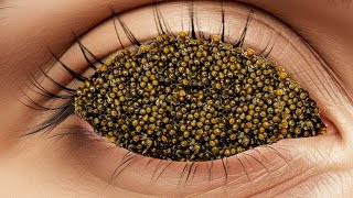 😲💉Insane  ASMR Eye Cleaning Deep Cleaning  Asmr Eye Treatment  Royal Asmr  Asmr Eye Exam [upl. by Gisella415]