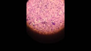 Schizont of malaria in the liver [upl. by Ophelia842]