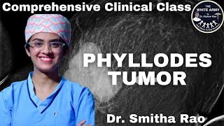 Phyllodes Tumor Case Presentation [upl. by Aehsal44]