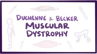 Duchenne amp Becker muscular dystrophy  causes symptoms treatment amp pathology [upl. by Eyak]