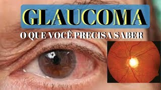 GLAUCOMA o que é e quais os seus sintomas  Dr André Wambier [upl. by Libove]