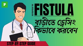 FISTULA IN ANO  How to do Dressing Fistula Treatment Care and Recovery [upl. by Lletnohs]