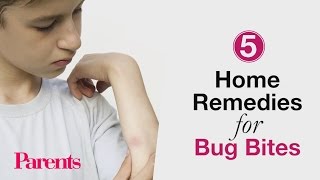 Home Remedies for Bug Bites  Parents [upl. by Suivatnad316]