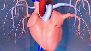 Catheter Ablation What is it and how does it help an irregular heart beat [upl. by Dric]