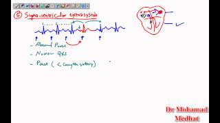 Arrhythmia ECG Dr Mohamad Medhat [upl. by Bernardina]