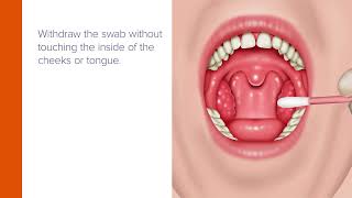 Aptima® Multitest Swab  ClinicianCollected Throat Specimen Collection Guide [upl. by Nibla]