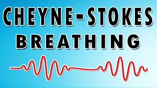 Breathing in Waves Understanding CheyneStokes Respiratory Rhythm [upl. by Cleve221]