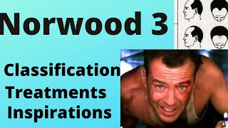 Norwood 3 Hairline Survival Guide  Classification Treatments and More [upl. by Ailina]