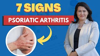 Psoriatic Arthritis 7 Signs and Symptoms  A Rheumatologist Review [upl. by Allit]