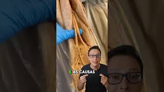 Nervo Ciático 😮🦵 curiosidades enfermagem medicina medico saude enfermeira anatomia ciatico [upl. by Dante]